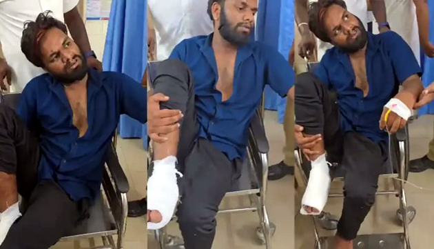 ರೌಡಿ ಗುಂಡನಿಗೆ ಪೊಲೀಸರಿಂದ ಗುಂಡೇಟು