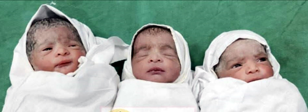 ತ್ರಿವಳಿ ಮಕ್ಕಳಿಗೆ ಜನ್ಮ ನೀಡಿದ ಮಹಿಳೆ