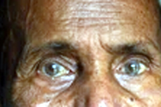 ಮೃತನ ಕಣ್ಣು ದಾನ ಮಾಡಿದ ಕುಟುಂಬದವರು