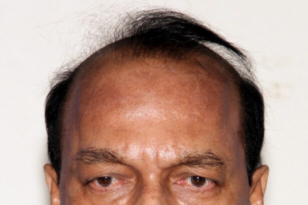 ಆರ್.ಎಂ. ಮಂಜುನಾಥ ಗೌಡ ವಿರುದ್ದ ಇಡಿ ಪ್ರತ್ಯೇಕ ಪ್ರಕರಣ