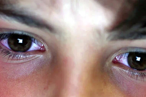 ಎರಡೂ ಕಣ್ಣು ಕಾಣದ್ದಕ್ಕೆ ಮನನೊಂದು ಆತ್ಮಹತ್ಯೆ